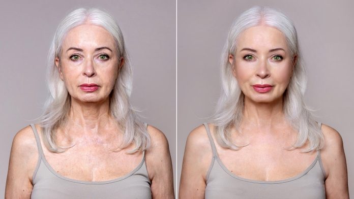 Celebrity plastic surgeon reveals when it’s too soon for a facelift, and when waiting can backfire