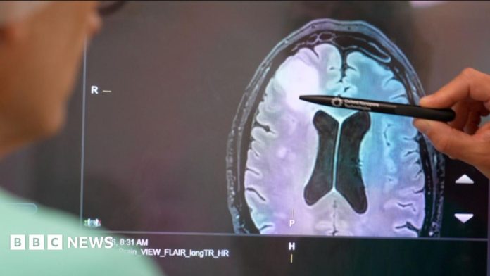 How a rapid new test is helping brain tumour patients
