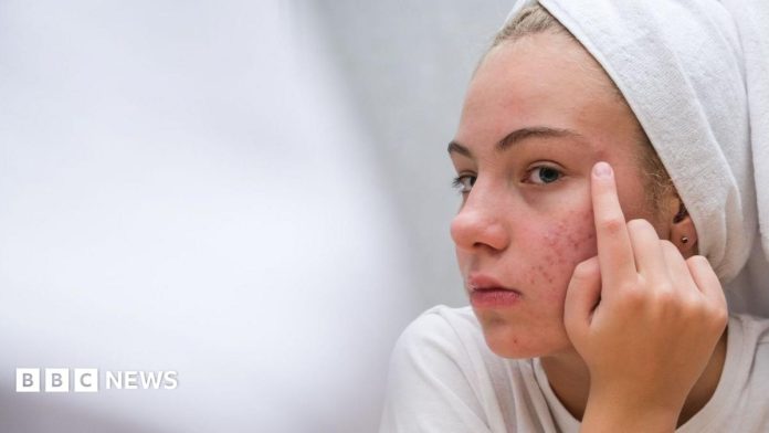 The simple skincare routine for teens that actually works – and five expert tips
