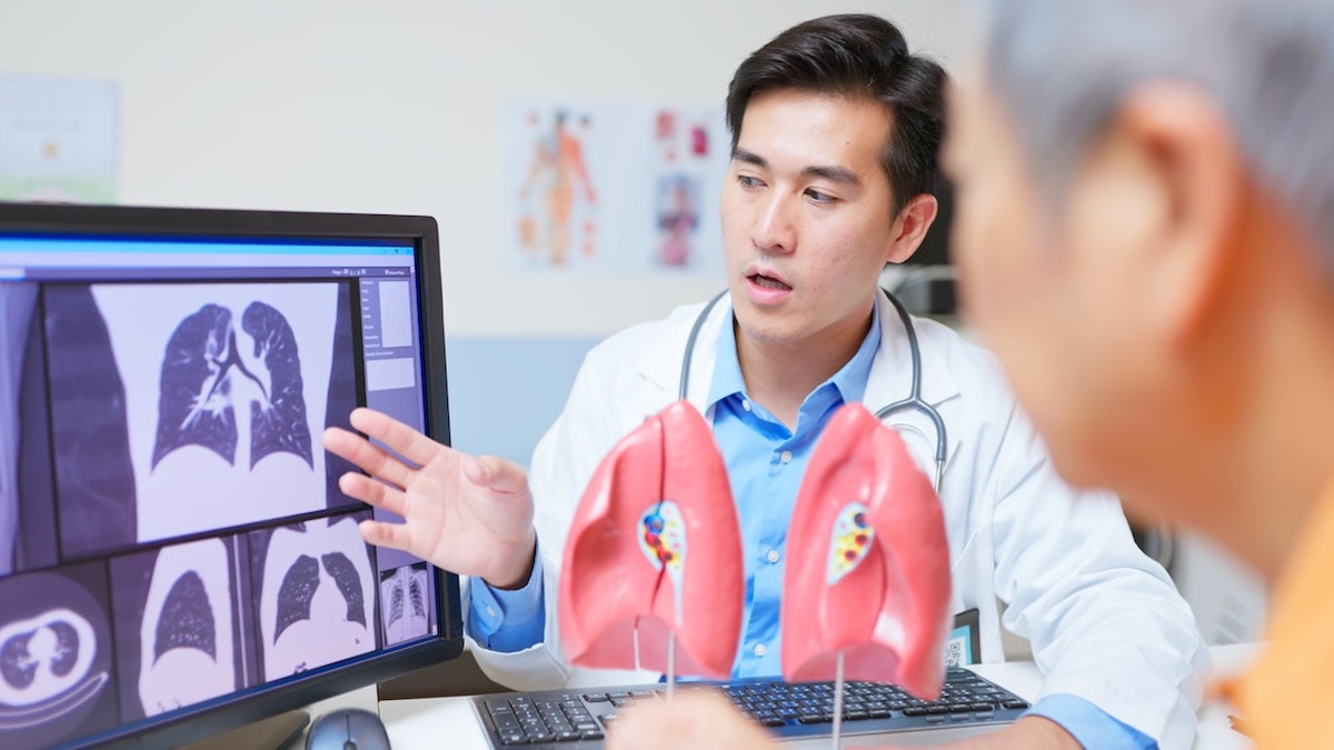 Doctor explaining lung scan