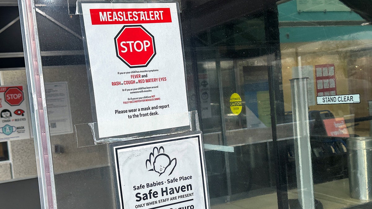 Measles