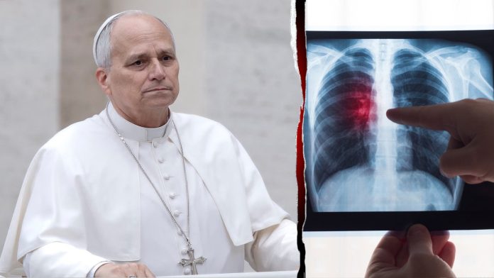 Pope Leo’s lung tumor raises questions about cancer risk for nonsmokers