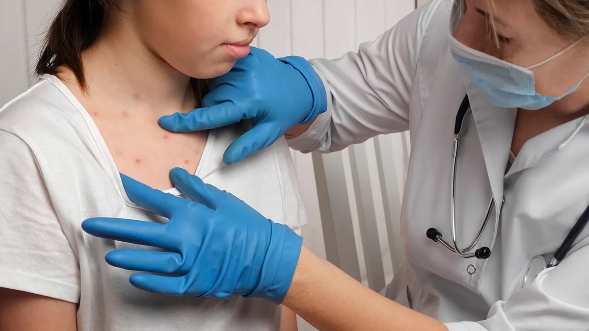girl with measles bumps on chest checked by doctor