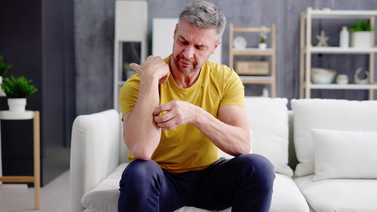 Man with itchy rash